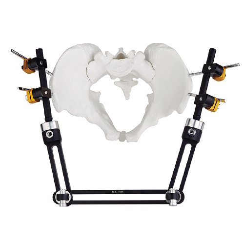 Pelvic Fragment External Fixator - Type C