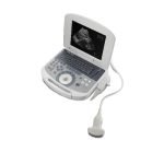 Dolphi® Pro Portable B:W Ultrasound Scanner-7|Dolphi® Pro Portable B:W Ultrasound Scanner-1|Dolphi® Pro Portable B:W Ultrasound Scanner-2|Dolphi® Pro Portable B:W Ultrasound Scanner-3|Dolphi® Pro Portable B:W Ultrasound Scanner-5|Dolphi® Pro Portable B:W Ultrasound Scanner-6|Dolphi® Pro Portable B:W Ultrasound Scanner-8|Dolphi® Pro Portable B:W Ultrasound Scanner-4|Dolphi® Pro Portable B:W Ultrasound Scanner-9|Dolphi® Pro Portable B:W Ultrasound Scanner-10|Dolphi® Pro Portable B:W Ultrasound Scanner-11