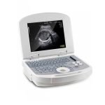 Dolphi® Pro Portable B:W Ultrasound Scanner-7|Dolphi® Pro Portable B:W Ultrasound Scanner-1|Dolphi® Pro Portable B:W Ultrasound Scanner-2|Dolphi® Pro Portable B:W Ultrasound Scanner-3|Dolphi® Pro Portable B:W Ultrasound Scanner-5|Dolphi® Pro Portable B:W Ultrasound Scanner-6|Dolphi® Pro Portable B:W Ultrasound Scanner-8|Dolphi® Pro Portable B:W Ultrasound Scanner-4|Dolphi® Pro Portable B:W Ultrasound Scanner-9|Dolphi® Pro Portable B:W Ultrasound Scanner-10|Dolphi® Pro Portable B:W Ultrasound Scanner-11