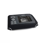 ||||Portable Digital Ultrasound Scanner-9|Portable Digital Ultrasound Scanner-8|Portable Digital Ultrasound Scanner-7