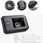 ||||Portable Digital Ultrasound Scanner-9|Portable Digital Ultrasound Scanner-8|Portable Digital Ultrasound Scanner-7