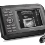 Sonovet Palm Veterinary Ultrasound Scanner with Rectal Probe-3|Sonovet Palm Veterinary Ultrasound Scanner with Rectal Probe-2|Sonovet Palm Veterinary Ultrasound Scanner with Rectal Probe-1