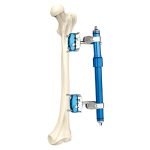 orthopedic-_0005s_0001_7100-20