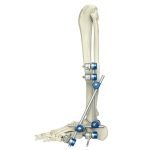 orthopedic-_0005s_0004_7100-17