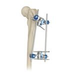 orthopedic-_0005s_0006_7100-15